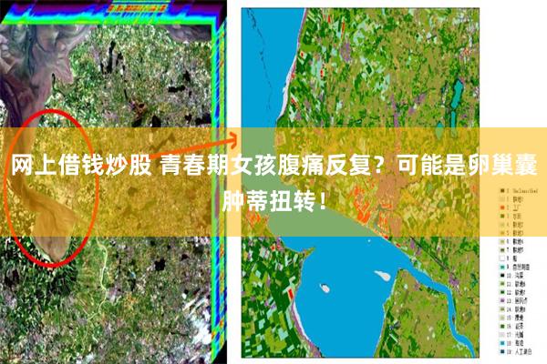 网上借钱炒股 青春期女孩腹痛反复?可能是卵巢囊肿蒂扭转!
